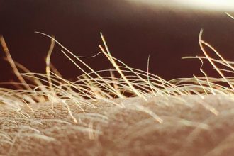 Itching May Have Its Own Sensory Organ : ScienceAlert