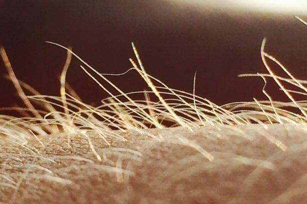 Itching May Have Its Own Sensory Organ : ScienceAlert