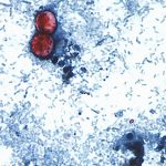 Mastercard Patented A Tool That Could Have Cracked This Summer’s Cyclospora Outbreak. It Was Never Deployed