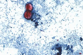 Mastercard Patented A Tool That Could Have Cracked This Summer’s Cyclospora Outbreak. It Was Never Deployed