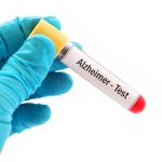 New Alzheimer’s Blood Tests Are Easy. But Do You Really Want One?