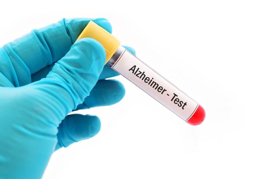 New Alzheimer’s Blood Tests Are Easy. But Do You Really Want One?