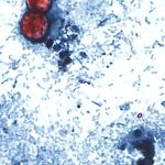 New cyclospora, peptide panel, autism: Morning Rounds