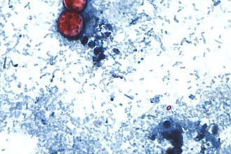 New cyclospora, peptide panel, autism: Morning Rounds