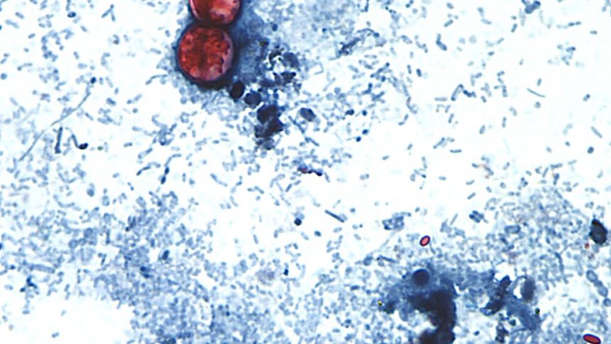 New cyclospora, peptide panel, autism: Morning Rounds