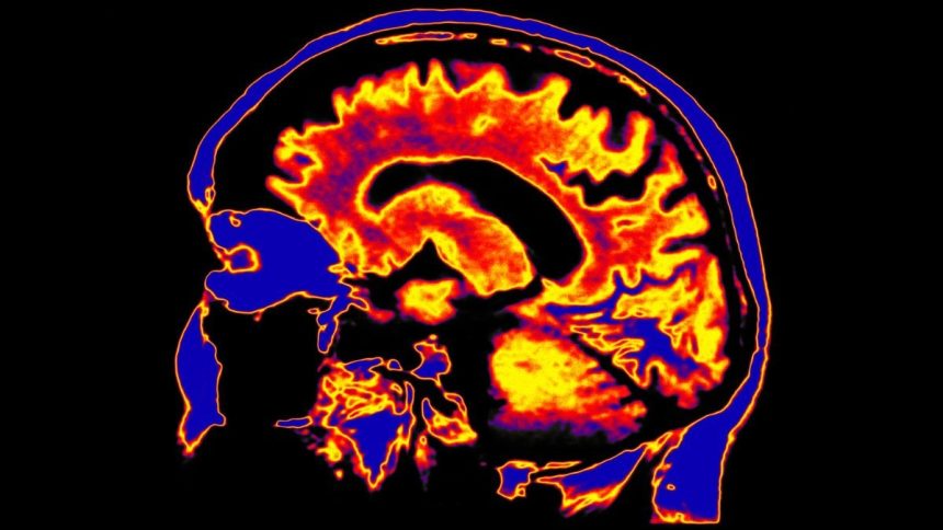 Scientists Discover a Potential Driver of Chronic Fatigue Syndrome Hiding Deep in The Brain : ScienceAlert
