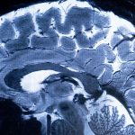 Scientists Witness Remarkable Brain Cell ‘Takeover’ in Midlife : ScienceAlert