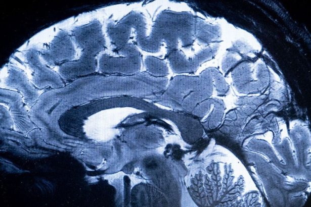 Scientists Witness Remarkable Brain Cell ‘Takeover’ in Midlife : ScienceAlert
