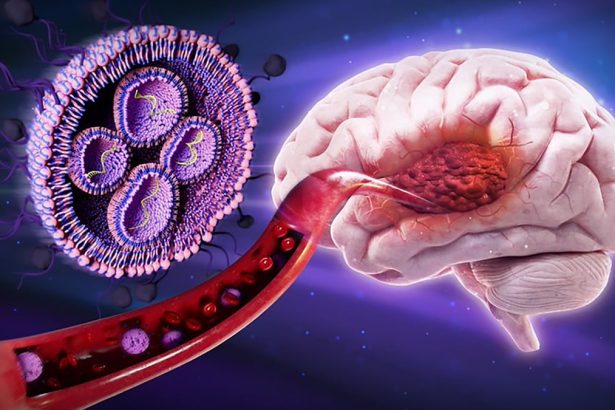 Sugar-Coated Nanoparticles Shrink Deadly Brain Tumors in Mice : ScienceAlert