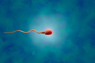 Tansplanted testicular tissue grew sperm in an infertile patient