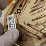 Alfalfa Sprout Outbreak Linked To Food-Poisoning In 15 States