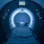 Doctors turn to MRI to improve prostate cancer screening accuracy