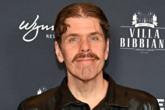 Perez Hilton ‘Will Require Surgery’ After Live Stream Incident