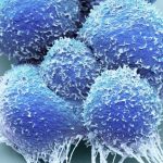 Science, risks and data behind focal therapy for prostate cancer