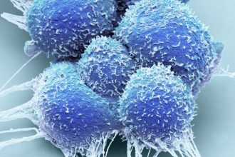 Science, risks and data behind focal therapy for prostate cancer