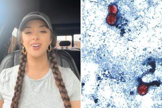 TikTok food critic Christina Hart details ‘miserable’ experience of contracting ‘explosive diarrhea’ parasite